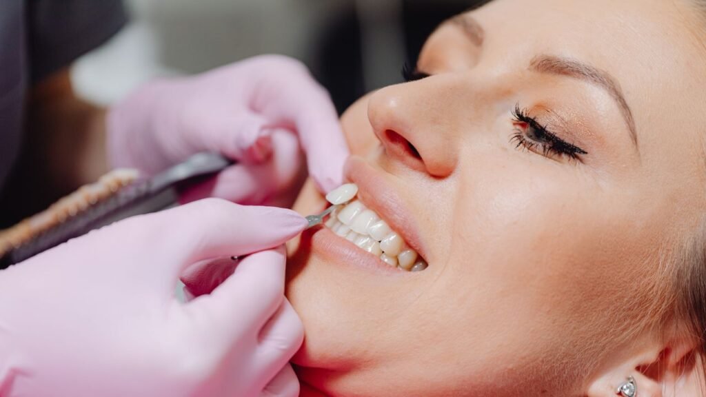 mitos e verdades sobre o procedimento das facetas de resina