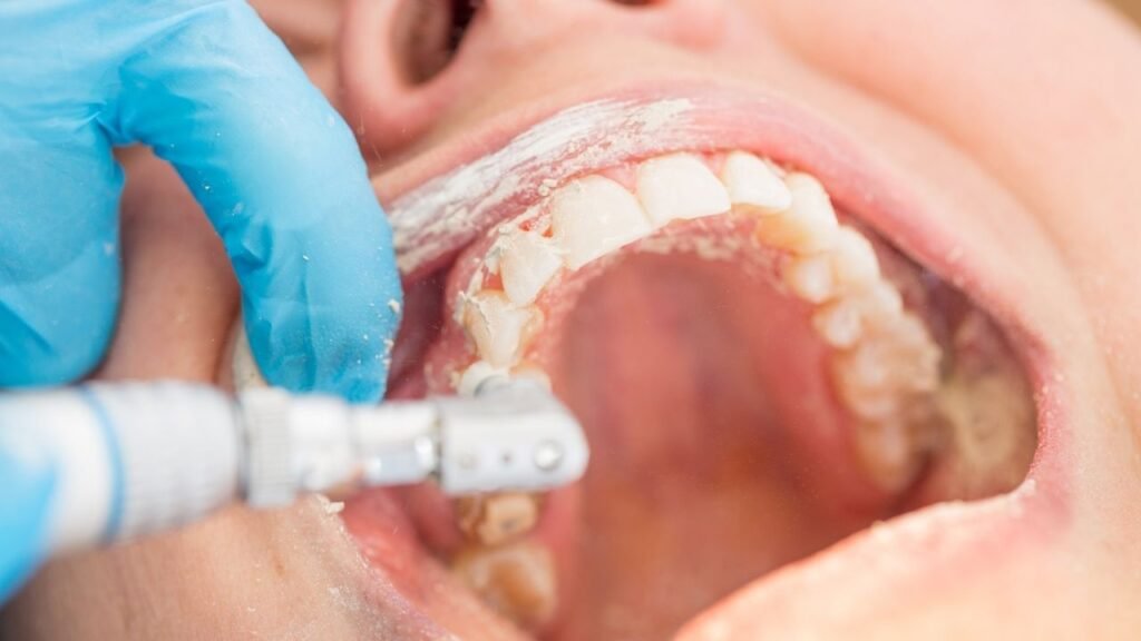 paciente mais uma vez realizando o processo de limpeza dentaria