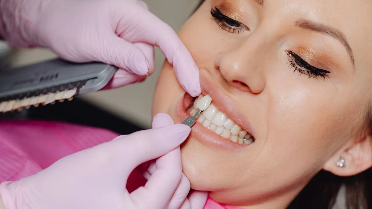 dentista colocando faceta de resina nos dentes de uma paciente