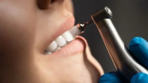 paciente passando por um procedimento de limpeza nos dentes no dentista