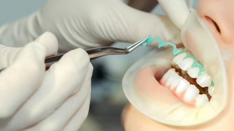 paciente em camaçari no processo de clareamento dental com o dr lucas mota