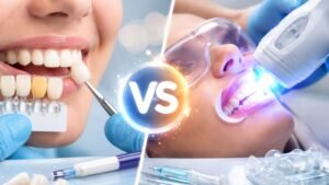 escolha entre facetas de resina e clareamento dental