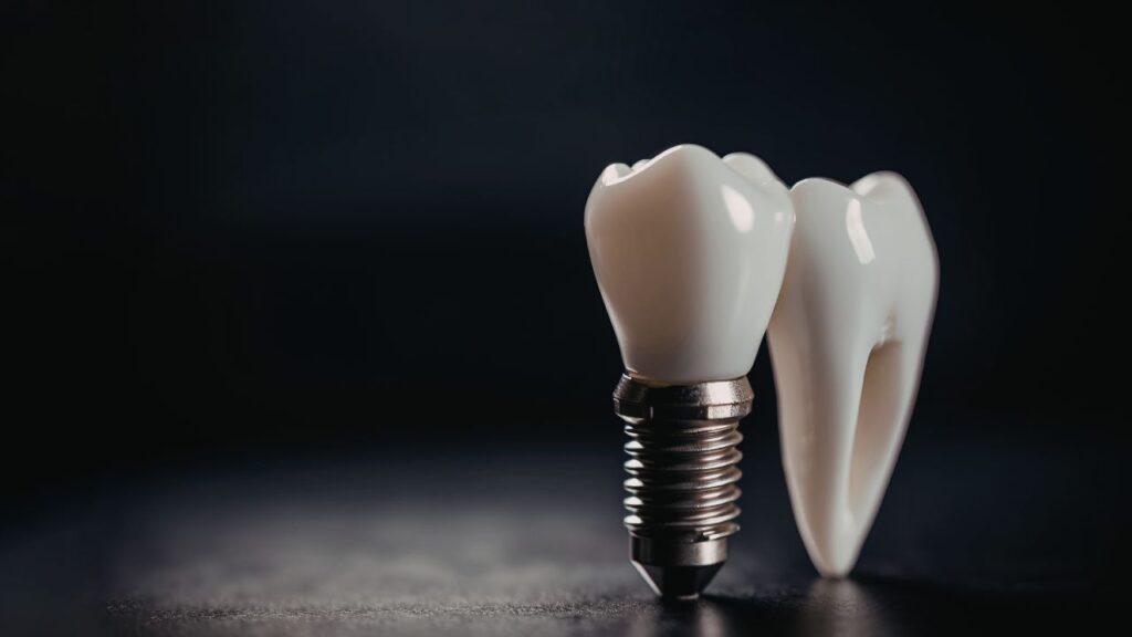 funcionamento de um implante dentário e suas diferenças entre um dente normal